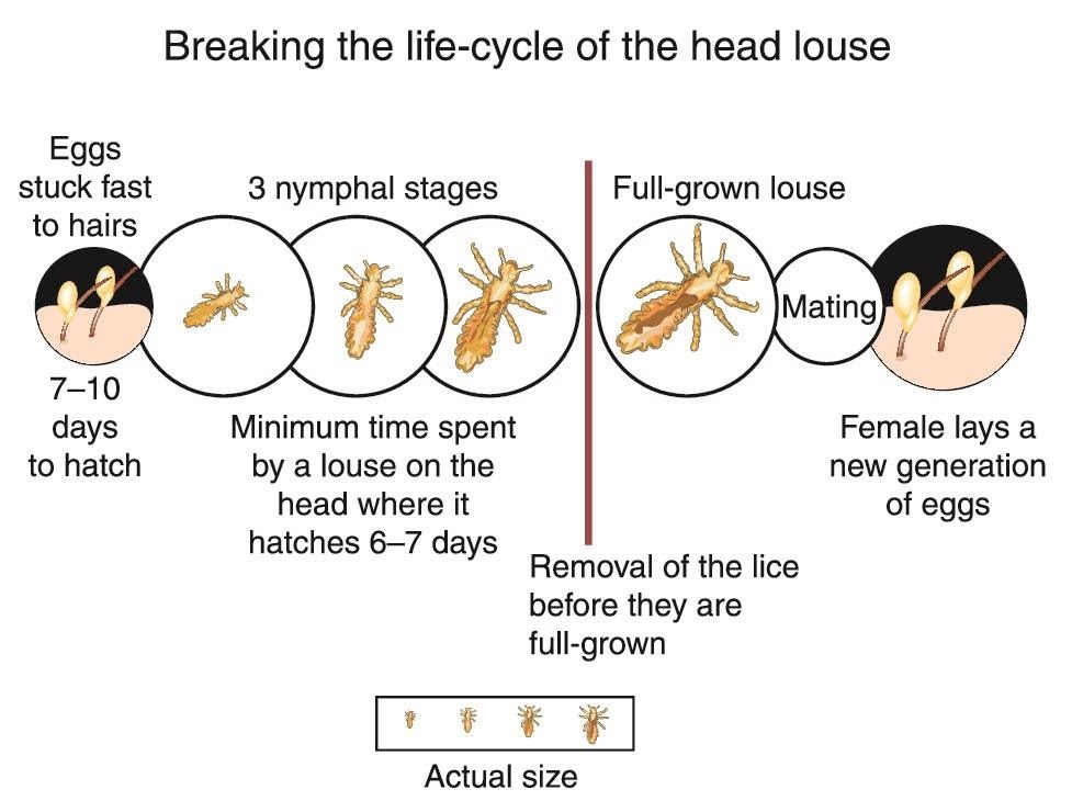 Where Do Lice Come From? LiceDoctors
